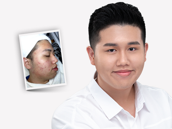 Before and after — Brandon