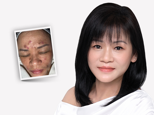 Before and after — Cindy