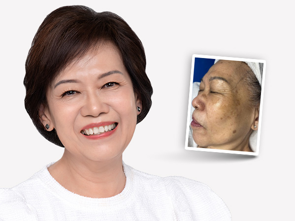 Before and after — Elaine