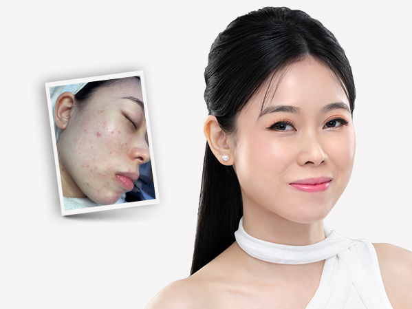 Before and after — Hui Ying