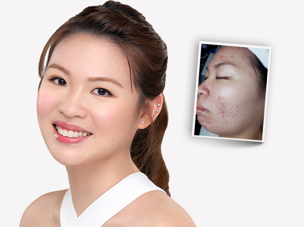Before and after — Joreen
