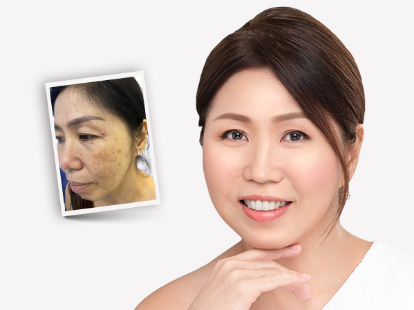 Before and after — Katherine