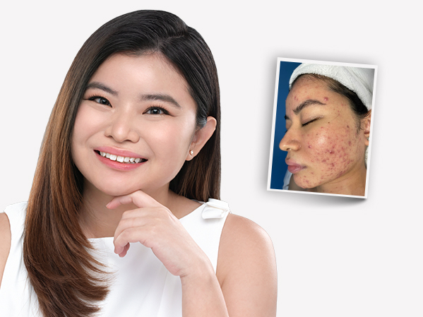 Before and after — Pei See