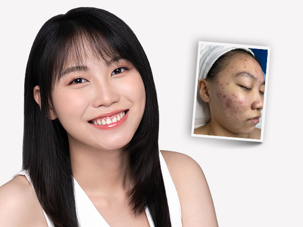 Before and after — Xing Wen